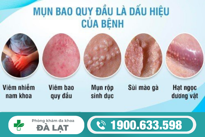 Hình ảnh minh họa